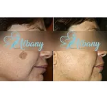 Albany Cosmetic and Laser Centre