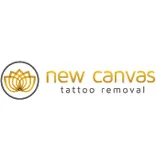 New Canvas Tattoo Removal