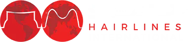 Scalp International Hairlines