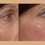 Arkansas Laser & Skin Care