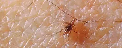 Flea Control Perth