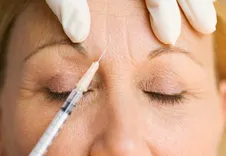 Botox Injections in Dubai