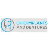 Ohio Implants and Dentures