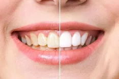 Cottonwood Dental Group