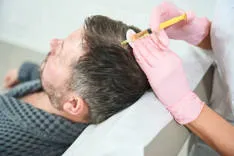 PRP Hair Treatment in Riyadh