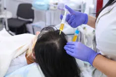 PRP Hair Treatment in Riyadh