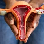 Cost of Ovarian Cancer Surgery in India