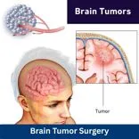 Best Deep Brain Stimulation Neurosurgeon Mumbai India