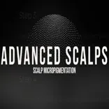 Advanced Scalps