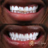 Dental Design Smile Miami