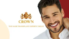 Crown Hair Transplant Experts