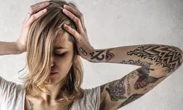 Laser Tattoo removal in Dubai