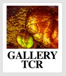 Gallery TCR