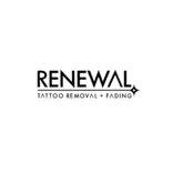 Renewal Tattoo Removal & Fading