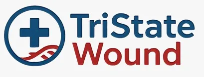Tristate wound