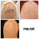 Zapatat